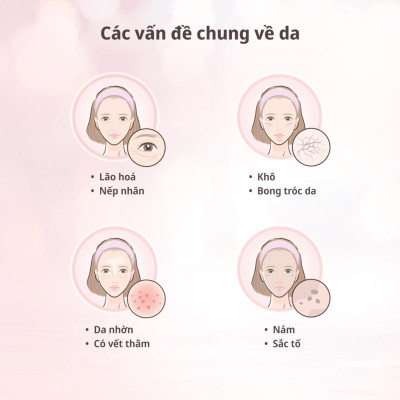 OSIM Máy massage mắt uGlow Eye