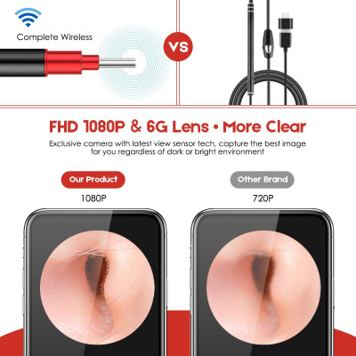 Dụng Cụ Lấy Ráy Tai Thông Minh Cảm Biến Bebird Camera Nội Soi Không Dây WiFi 6 Đèn LED và HD 1080P 2Megapixels