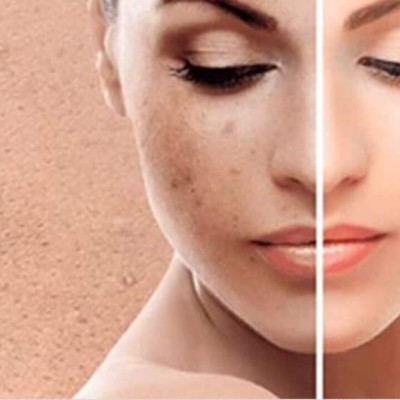 Viên Uống Trắng Da Chống Nắng Ladila Sunshine