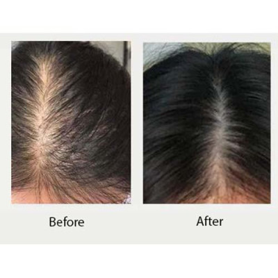 Dầu gội gừng trắng ngăn rụng và kích mọc tóc Weilaiya Ginger Shampoo 400ml