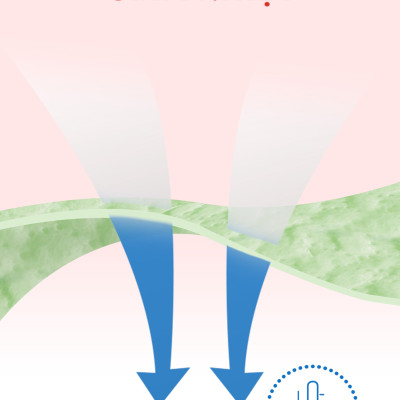 [TẶNG THÊM MIẾNG CHO SIZE L/XL/XXL] Combo 3 gói Tã quần Huggies Skincare Mega Jumbo M106/L96/XL84/XXL76