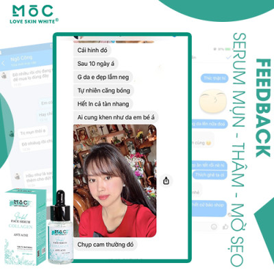 SERUM NGỪA MỤN THÂM - MỜ SẸO 25ML - MOC