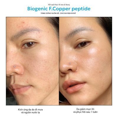 Biogenic F. Copper Peptide - Serum Phục Hồi Đa Tác Động - Giảm Kích ứng, Ngừa Oxy hóa, Sẹo Sau Mụn Twins Skin 30ml và 10ml