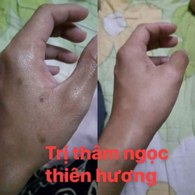 Tinh chất Ngọc Thiên Hương