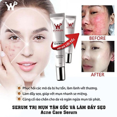 Serum Hỗ Trợ Làm Giảm Mụn It
