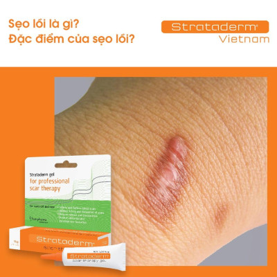 Strataderm 5g - Gel Silicone ngăn ngừa sẹo lồi, sẹo xấu, sẹo lâu năm