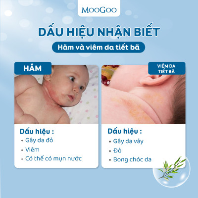 Kem dưỡng cho bé Viêm da tiết bã, Vảy nến chiết xuất Dầu tràm Moogoo Úc thuần chay, lành tính