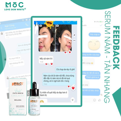 SERUM NGỪA NÁM - TÀN NHANG 25ML - MOC