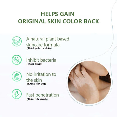 [Vilitigo] Kem Bôi Lang Ben, Hắc Lào, Nấm Ngứa, Vẩy Nến – Chiết Xuất Thảo Dược An Toàn