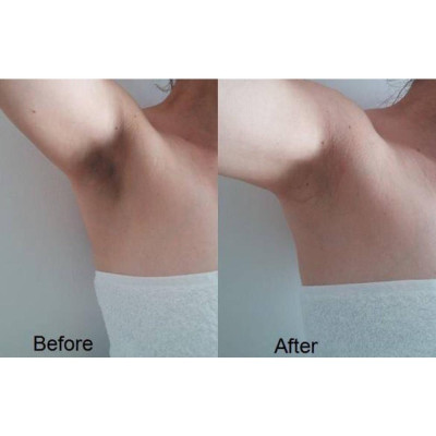 TẨY TẾ BÀO CHẾT VÙNG NÁCH SHIROWAKI HIME - THƯƠNG HIỆU HIMECOTO