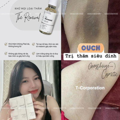 SERUM MỜ THÂM NÁM DƯỠNG DA TRẮNG SÁNG CHO DA MẶT - DA BIKINI THE RENEWAL  20ML